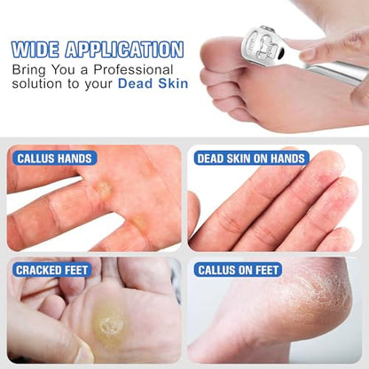 MIUKAA Callus Shaver Kit with 10 Blades, Callus Remover for Feet & Hands, Professional Dead Skin and Corn Removal Tool, Heel Scraper for Cracked Heels - Pedicure Tools for Smooth Feet