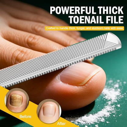 FVION Toenail File for Thick Nails and Toenail Lifter, 2pcs Stainless Steel Nail File and Ingrown Relief Set, Heavy Duty Metal Emery Board for Seniors, Men & Women Pedicure Tool (Green) - color: Green Handle