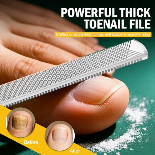 FVION Toenail File for Thick Nails and Toenail Lifter, 2pcs Stainless Steel Nail File and Ingrown Relief Set, Heavy Duty Metal Emery Board for Seniors, Men & Women Pedicure Tool (Black) - color: Black Handle