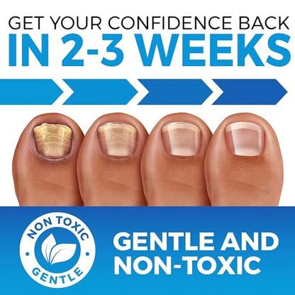 Toenail Fungus Treatment Extra Strength (FDA REGISTERED) - Fungi Nail Fungus Cream - XL - Nail Strengthener and Growth Improved Formula (Made in USA) 2.54 Fl oz - size: 2.54 Fl Oz (Pack of 1)