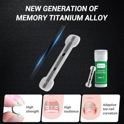 Titanium Alloy Ingrown Toenail Treatment, Nail Tools, and Ingrown Toenail Removal Kit Specially Designed for Curved Nail Repair and Ingrown Toenail Corrector (0.59/0.67in) - size: 0.59/0.67in