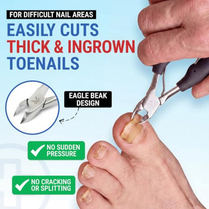 Toenail Clippers for Thick Toenails – KLIPP 15 mm Wide Jaw Thick Fingernail and Toenail Cutter with Curved Stainless-Steel Blades for Seniors (Eagle Beak) - size: Eagle Beak