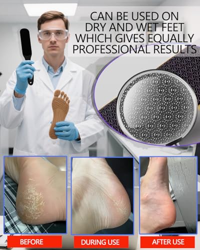 Nano Glass Foot File, Callus Remover for Feet, Wet and Dry Feet Dead Skin Remover, Durable Foot Scrubber, Double-Sided Safe Hygienic Pedicure Tools for Feet, Long Lasting Foot Care Soft Smooth Feet - style: Black