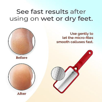 Microplane Colossal Foot File Scraper - The Original Stainless Steel Foot Rasp, Dead Skin/Callus Remover for Feet, Gentle Foot Scrubber, Pedicure Tools for Salon-Quality Foot Care, Red - style: Red