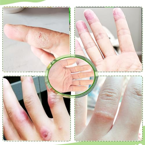 Gel Finger Cots,20 Pcs Silicone Finger Protectors Covers,Finger Caps Finger Sleeves Thumb Protector Bandage,Gel Finger Support Protector (20)